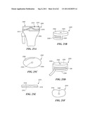 Patient Selectable Joint Arthroplasty Devices and Surgical Tools diagram and image