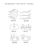 Patient Selectable Joint Arthroplasty Devices and Surgical Tools diagram and image