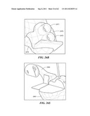 Patient Selectable Joint Arthroplasty Devices and Surgical Tools diagram and image