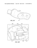 Patient Selectable Joint Arthroplasty Devices and Surgical Tools diagram and image