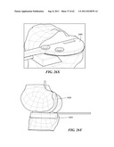 Patient Selectable Joint Arthroplasty Devices and Surgical Tools diagram and image