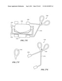 Patient Selectable Joint Arthroplasty Devices and Surgical Tools diagram and image