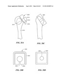 Patient Selectable Joint Arthroplasty Devices and Surgical Tools diagram and image