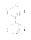 Patient Selectable Joint Arthroplasty Devices and Surgical Tools diagram and image