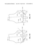 Patient Selectable Joint Arthroplasty Devices and Surgical Tools diagram and image