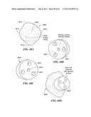 Patient Selectable Joint Arthroplasty Devices and Surgical Tools diagram and image