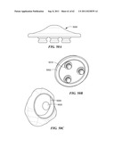 Patient Selectable Joint Arthroplasty Devices and Surgical Tools diagram and image