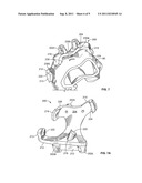 PATIENT-SPECIFIC COMPUTED TOMOGRAPHY GUIDES diagram and image