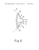 VACUUM EXTRACTOR CUP FOR DELIVERY diagram and image