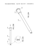 METHOD AND APPARATUS FOR SPINAL FIXATION diagram and image