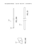 METHOD AND APPARATUS FOR SPINAL FIXATION diagram and image
