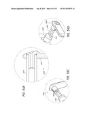 METHOD AND APPARATUS FOR SPINAL FIXATION diagram and image