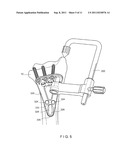 Plating Concept for Distal Radial Fractures diagram and image