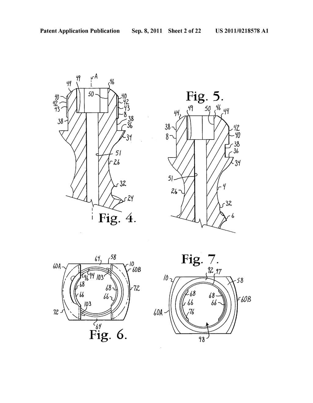 Polyaxial bone screw with cam connection and lock and release insert - diagram, schematic, and image 03