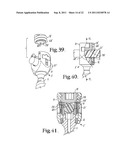 Polyaxial bone screw with cam connection and lock and release insert diagram and image