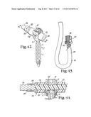 Polyaxial bone screw with cam connection and lock and release insert diagram and image