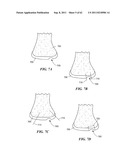 Patient Selectable Joint Arthroplasty Devices and Surgical Tools diagram and image