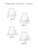 Patient Selectable Joint Arthroplasty Devices and Surgical Tools diagram and image