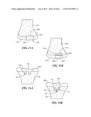 Patient Selectable Joint Arthroplasty Devices and Surgical Tools diagram and image