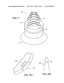 Patient Selectable Joint Arthroplasty Devices and Surgical Tools diagram and image