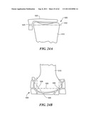 Patient Selectable Joint Arthroplasty Devices and Surgical Tools diagram and image