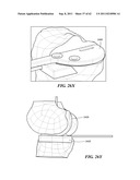 Patient Selectable Joint Arthroplasty Devices and Surgical Tools diagram and image