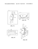 Patient Selectable Joint Arthroplasty Devices and Surgical Tools diagram and image