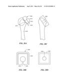 Patient Selectable Joint Arthroplasty Devices and Surgical Tools diagram and image