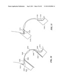 Patient Selectable Joint Arthroplasty Devices and Surgical Tools diagram and image