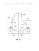 Patient Selectable Joint Arthroplasty Devices and Surgical Tools diagram and image