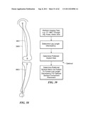 Patient Selectable Joint Arthroplasty Devices and Surgical Tools diagram and image