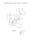 Patient Selectable Joint Arthroplasty Devices and Surgical Tools diagram and image