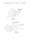 Patient Selectable Joint Arthroplasty Devices and Surgical Tools diagram and image