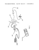 SYSTEMS, DEVICES AND METHODS FOR THE TREATMENT OF TINNITUS diagram and image