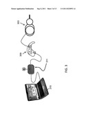 SYSTEMS, DEVICES AND METHODS FOR THE TREATMENT OF TINNITUS diagram and image