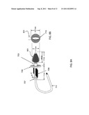 SYSTEMS, DEVICES AND METHODS FOR THE TREATMENT OF TINNITUS diagram and image