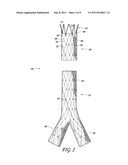 ENDOLUMINAL VASCULAR PROSTHESIS diagram and image