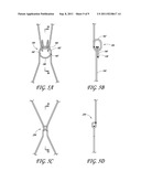 ENDOLUMINAL VASCULAR PROSTHESIS diagram and image