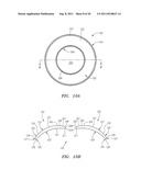 Small Diameter Inlays diagram and image