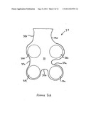 Article Of Footwear With A Sole Structure Having Support Elements And An     Indented Plate diagram and image