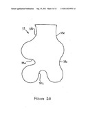 Article Of Footwear With A Sole Structure Having Support Elements And An     Indented Plate diagram and image