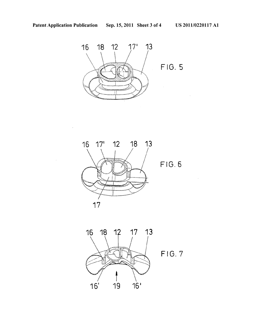 LARYNX MASK HAVING AN ESOPHAGEAL PASSAGE - diagram, schematic, and image 04