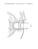 SKYDIVING EQUIPMENT TO DISTRIBUTE THE TENSION FORCES OF A DROGUE PARACHUTE diagram and image