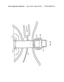 SKYDIVING EQUIPMENT TO DISTRIBUTE THE TENSION FORCES OF A DROGUE PARACHUTE diagram and image