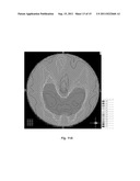 RADIATION SCULPTING BY COORDINATING ROTATION OF FIXED BEAMS AND MOTION OF     PATIENT SUPPORT SYSTEM diagram and image