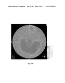 RADIATION SCULPTING BY COORDINATING ROTATION OF FIXED BEAMS AND MOTION OF     PATIENT SUPPORT SYSTEM diagram and image