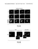 Mesenchymal stem cells that express increased amounts of anti-apoptotic     proteins diagram and image