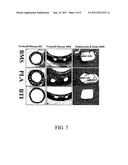  DRUG-RELEASE COMPOSITION HAVING A THERAPEUTIC CARRIER diagram and image