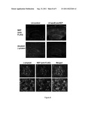 COMPOUNDS FOR REVERSING AND INHIBITING PROTEIN AGGREGATION, AND METHODS     FOR MAKING AND USING THEM diagram and image