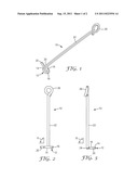 CANTILEVER ARM FOR ORTHODONTIC ANCHORAGE diagram and image